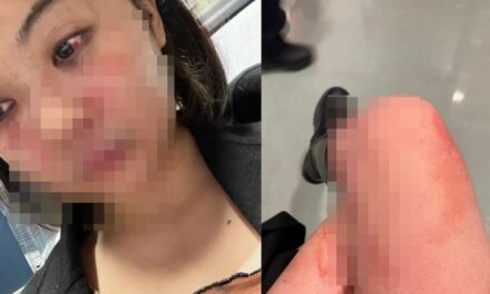 หญิงไทย อายุ 23 ปี โดนทำร้ายที่นิวยอร์ค